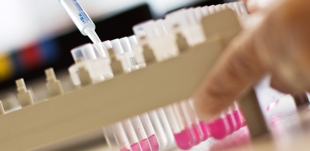 Pipetting of liquids