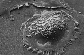 Osteoclast